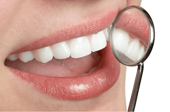 teeth-whitening-jacksonville